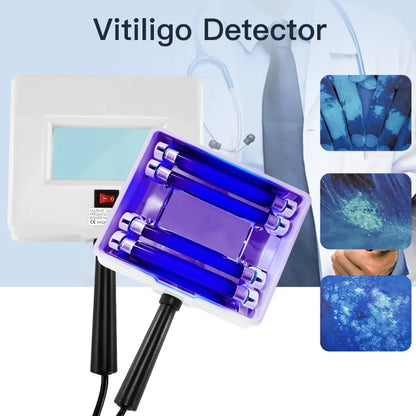 Woods Lamp Skin Analyzer for Skin Testing Home Use Salon SPA Machine Facial Skin Scanner UV Magnifying Analyzer